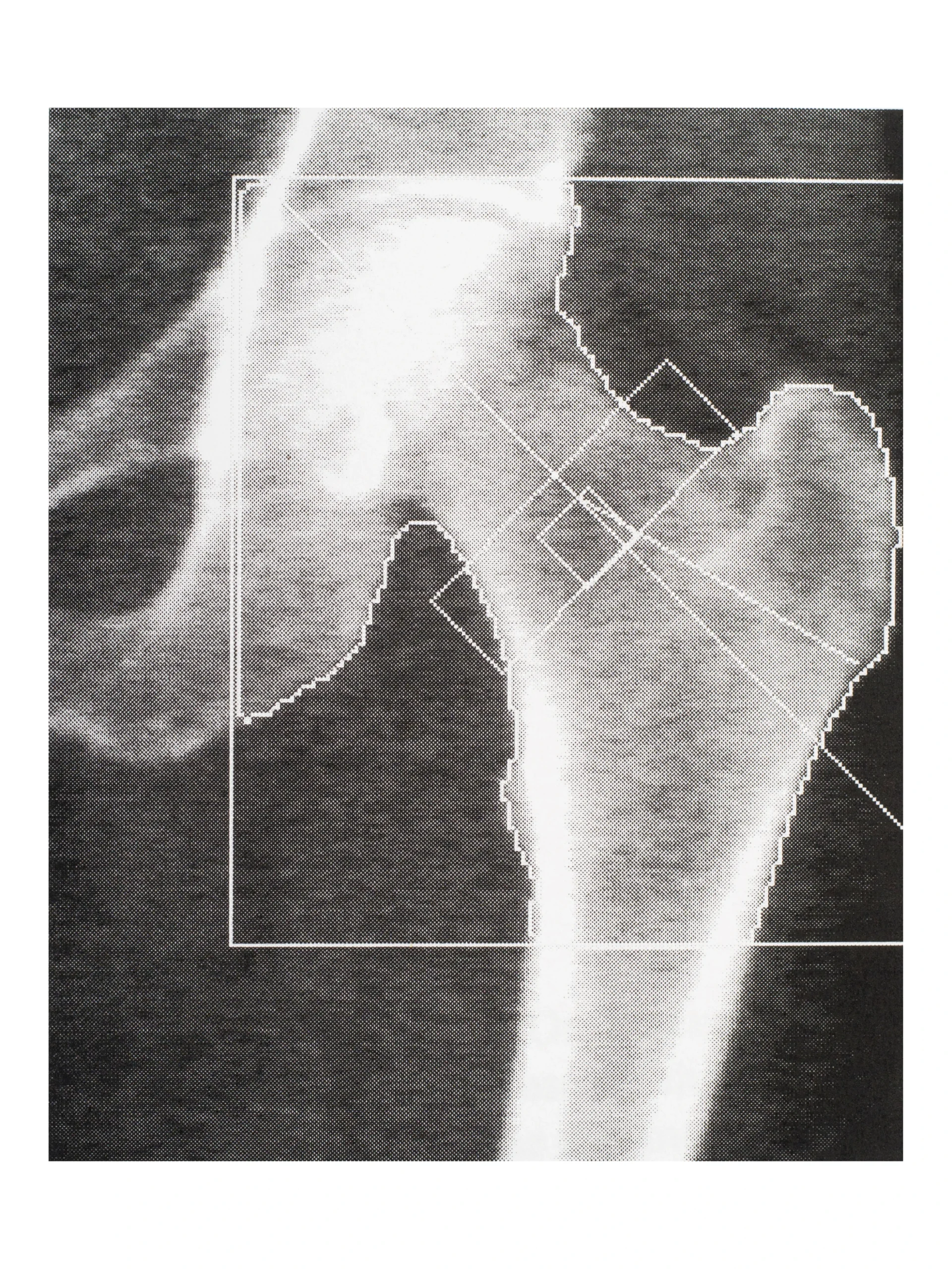 X-ray image of a hip joint.